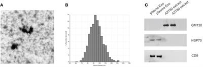 Plasma exosomal miR-320d, miR-4479, and miR-6763-5p as diagnostic biomarkers in epithelial ovarian cancer